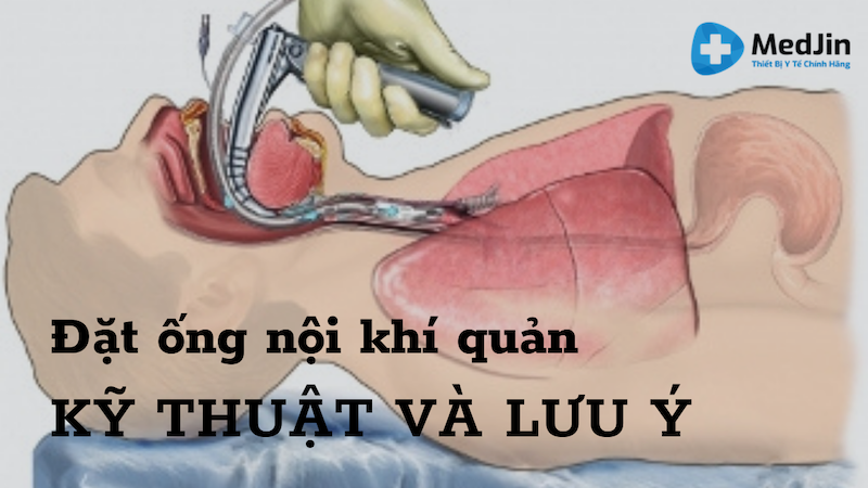  Đặt Ống Nội Khí Quản: Quy Trình Kỹ Thuật Chuẩn Và Lưu Ý Illustration 